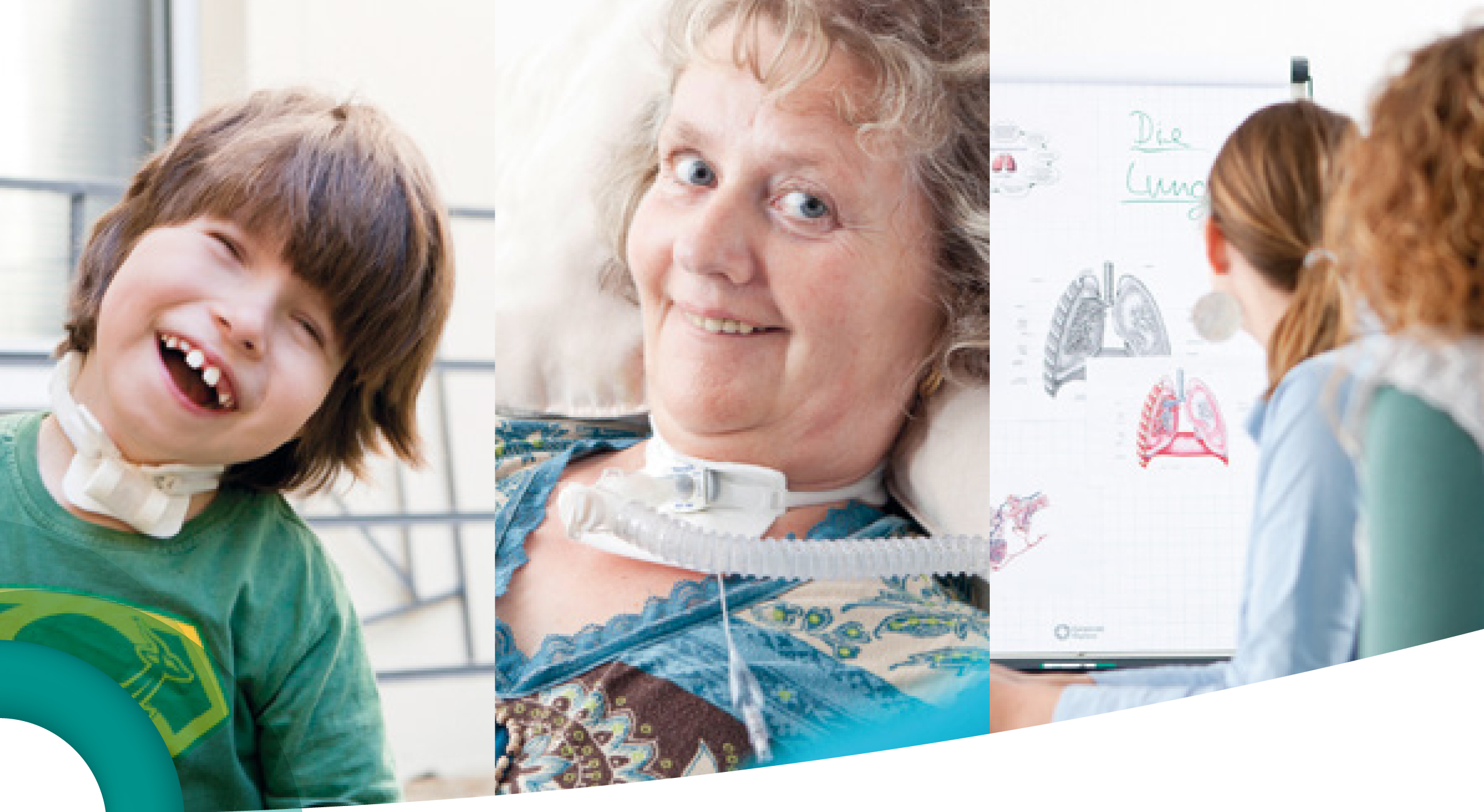 Basiswissen Tracheostoma/Trachealkanülen und Pflegetherapeutisches Handeln